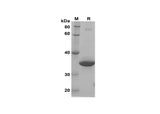 SDS-PAGE analysis of Human IFNα2 proteins, 2 μg/lane of Recombinant Human IFNα2 proteins was resolved with SDS-PAGE under reducing conditions, showing bands at 35 kDa.