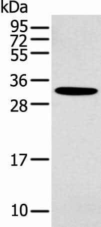 Anti-Human/Mouse NANOS1 Antibody