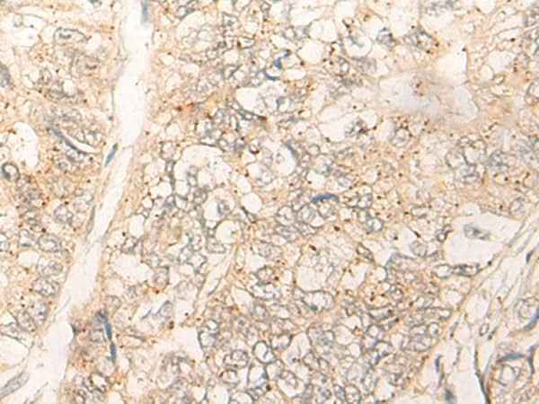 Anti-Human CUTA Antibody