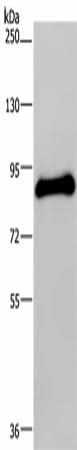 Anti-Human POMT1 Antibody - ABMIUM