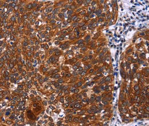 Anti-Human/Mouse/Rat USP2 Antibody