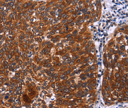 Anti-Human/Mouse/Rat USP2 Antibody - ABMIUM