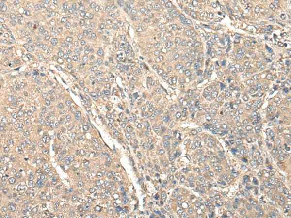 Anti-Human/Mouse C1orf106 Antibody