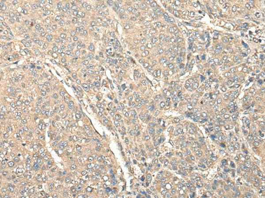 Anti-Human/Mouse C1orf106 Antibody