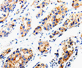 Anti-Human/Mouse COX16 Antibody - ABMIUM