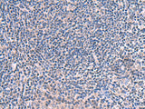 Immunohistochemistry of paraffin-embedded Human tonsil tissue using SCCPDH Polyclonal Antibody at dilution of 1:50(×200)