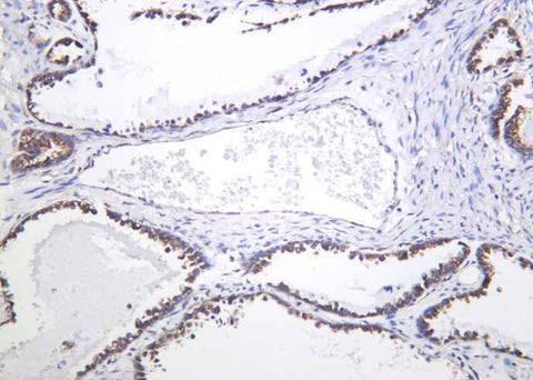 Anti-Human/Mouse/Rat DCLK1 Antibody [B1046] - ABMIUM