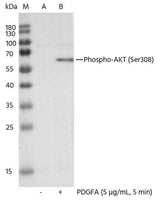 Anti-Human AKT1 Antibody [11A1] - ABMIUM