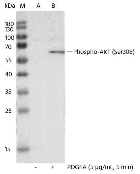 Anti-Human AKT1 Antibody [11A1] - ABMIUM