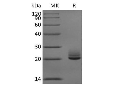 Recombinant Mouse Fibroblast Growth Factor 21/FGF-21 (C-6His) - ABMIUM