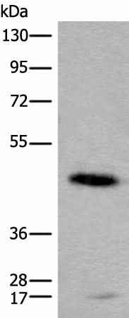 Anti-Human/Mouse/Rat CADM2 Antibody