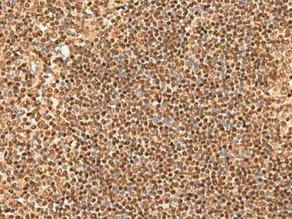Anti-Human/Mouse SIX6 Antibody