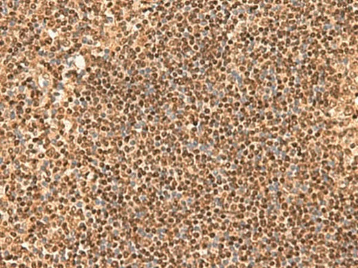 Immunohistochemistry of paraffin-embedded Human tonsil tissue using SIX6 Polyclonal Antibody at dilution of 1:50(×200)