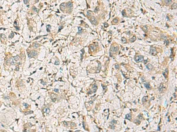 Anti-Human CMTM1 Antibody