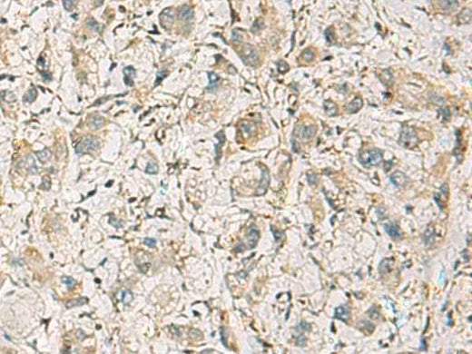 Anti-Human CMTM1 Antibody