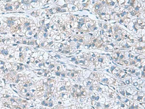 Anti-Human/Mouse GDF9 Antibody