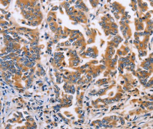 Anti-Human/Mouse DOK4 Antibody - ABMIUM