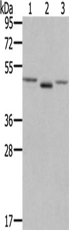 Anti-Human/Mouse/Rat FGFRL1 Antibody - ABMIUM