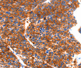 Anti-Human SEPT4 Antibody - ABMIUM