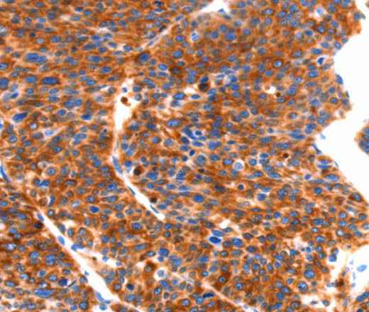 Anti-Human SEPT4 Antibody