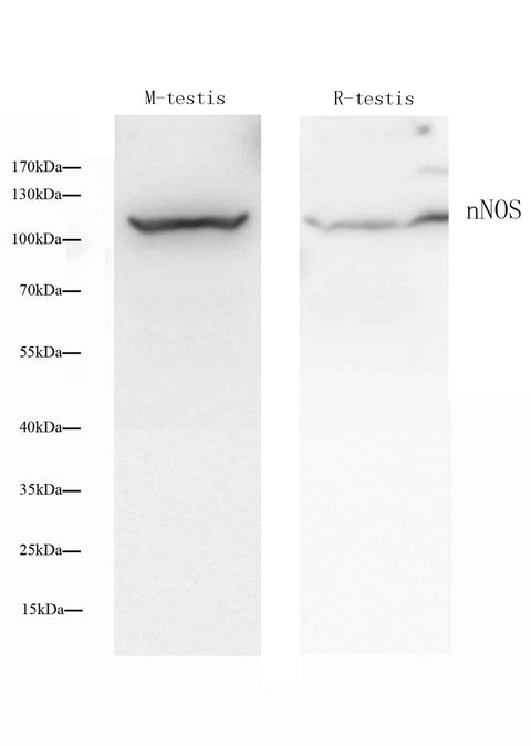 Western Blot analysis of various samples using NOS1 Polyclonal Antibody at dilution of 1:500.