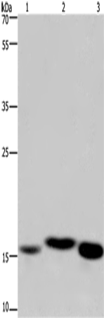 Anti-Human/Mouse/Rat Cytochrome b5 Antibody - ABMIUM
