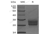 Recombinant Human NCR3/NKp30 Protein (His Tag) - ABMIUM