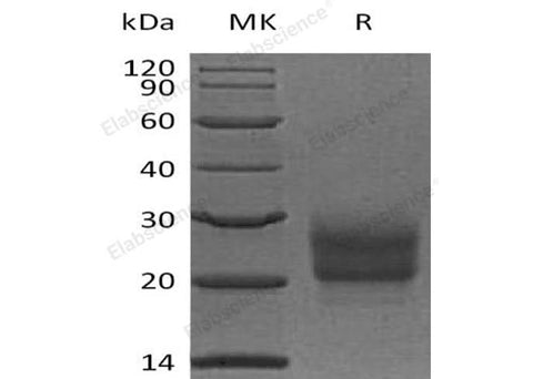 Recombinant Human NCR3/NKp30 Protein (His Tag) - ABMIUM