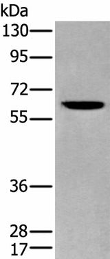 Western blot analysis of Human cerebrum tissue lysate using ZKSCAN1 Polyclonal Antibody at dilution of 1:400