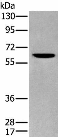 Western blot analysis of Human cerebrum tissue lysate using ZKSCAN1 Polyclonal Antibody at dilution of 1:400