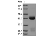 Recombinant Mouse Kallikrein 1/KLK1 Protein (His Tag) - ABMIUM