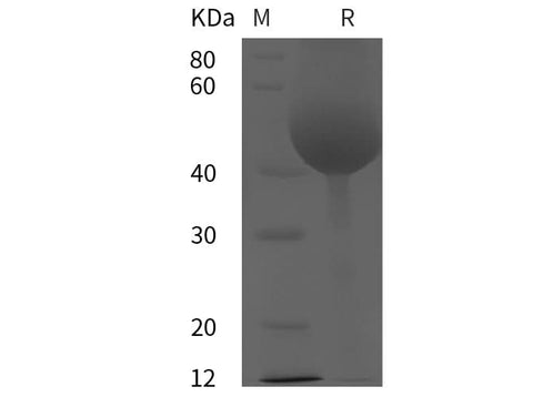 SDS-PAGE analysis of Rat Tissue factor/TF proteins, 2 μg/lane of Recombinant Rat Tissue factor/TF proteins was resolved with SDS-PAGE under reducing conditions, showing bands at 49 kDa.