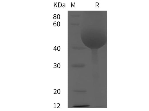 SDS-PAGE analysis of Rat Tissue factor/TF proteins, 2 μg/lane of Recombinant Rat Tissue factor/TF proteins was resolved with SDS-PAGE under reducing conditions, showing bands at 49 kDa.