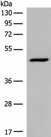 Western blot analysis of HL-60 cell lysate using DCP2 Polyclonal Antibody at dilution of 1:500