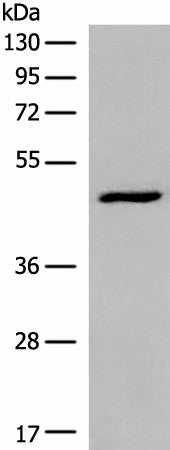 Western blot analysis of HL-60 cell lysate using DCP2 Polyclonal Antibody at dilution of 1:500