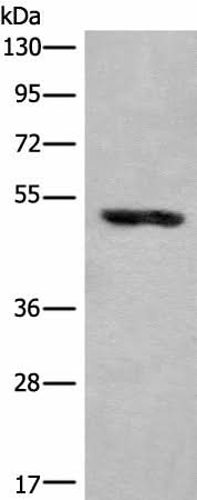 Western blot analysis of Human placenta tissue lysate using KLHDC2 Polyclonal Antibody at dilution of 1:400