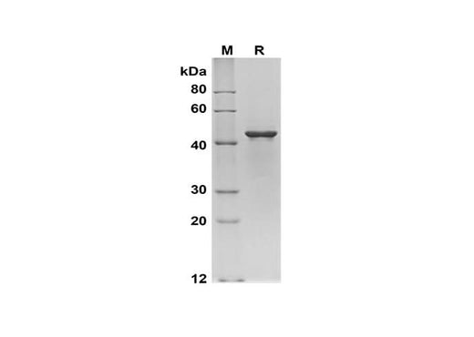 SDS-PAGE analysis of Human IA2/PTPRN proteins, 2 μg/lane of Recombinant Human IA2/PTPRN proteins was resolved with SDS-PAGE under reducing conditions, showing bands at 45 kDa.