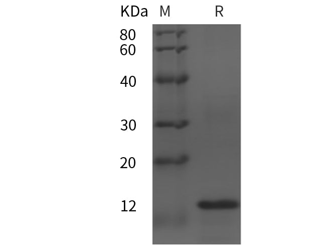 SDS-PAGE analysis of Human CCL28 proteins, 2 μg/lane of Recombinant Human CCL28 proteins was resolved with SDS-PAGE under reducing conditions, showing bands at 14 kDa.