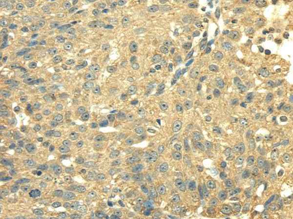 Anti-Human/Mouse/Rat SDHA Antibody