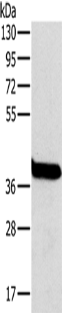 Anti-Human/Mouse/Rat OTC Antibody - ABMIUM