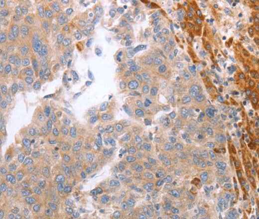 Anti-Human/Mouse NRTN Antibody