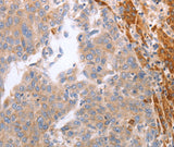 Anti-Human/Mouse NRTN Antibody - ABMIUM