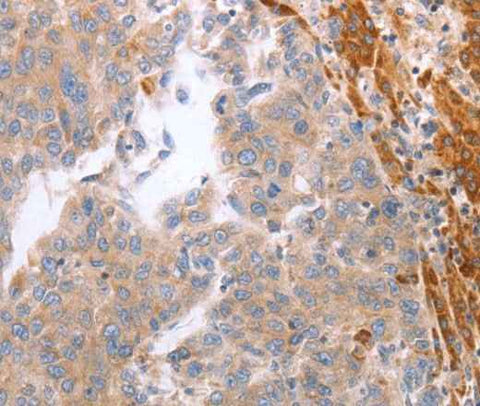 Anti-Human/Mouse NRTN Antibody