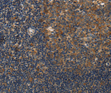 Anti-Human/Mouse DSP Antibody - ABMIUM