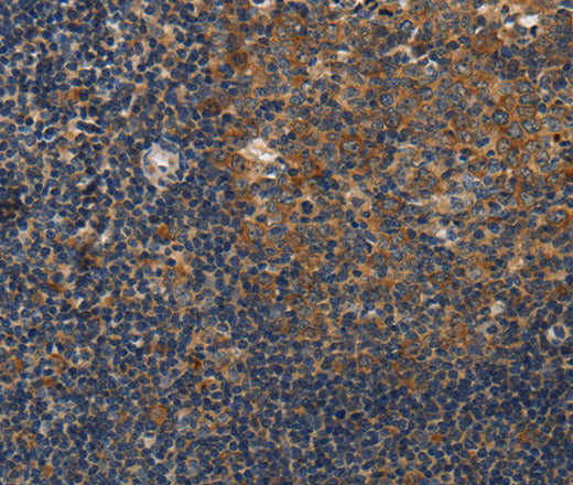 Anti-Human/Mouse DSP Antibody - ABMIUM