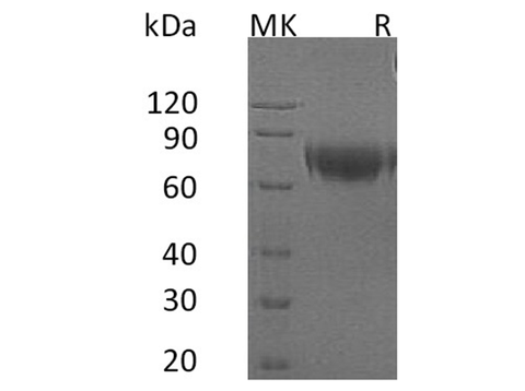 Recombinant Human IFNAR2 Protein (Fc Tag) - ABMIUM
