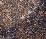 Anti-Human/Mouse/Rat NTMT1 Antibody - ABMIUM
