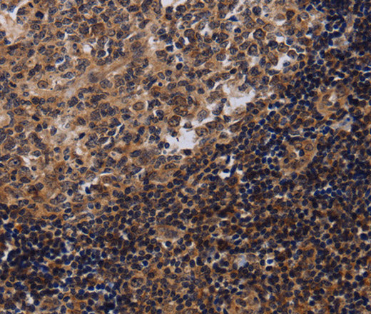 Anti-Human/Mouse/Rat NTMT1 Antibody - ABMIUM