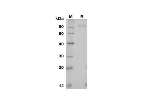 SDS-PAGE analysis of Human Fibroblast Activation Protein α/FAP proteins, 2 μg/lane of Recombinant Human Fibroblast Activation Protein α/FAP proteins was resolved with SDS-PAGE under reducing conditions, showing bands at 90 kDa.