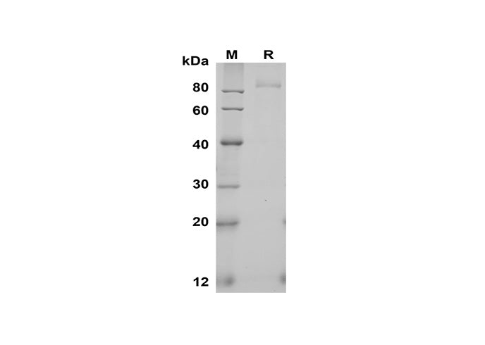 SDS-PAGE analysis of Human Fibroblast Activation Protein α/FAP proteins, 2 μg/lane of Recombinant Human Fibroblast Activation Protein α/FAP proteins was resolved with SDS-PAGE under reducing conditions, showing bands at 90 kDa.
